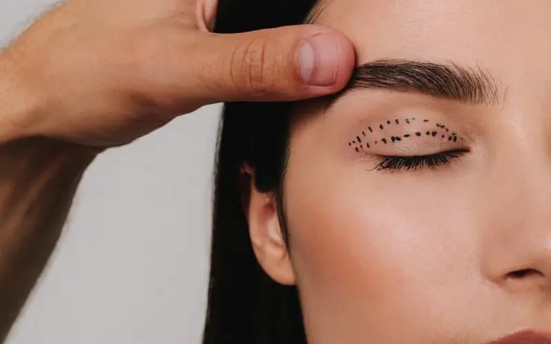 جراحی پلک بالا